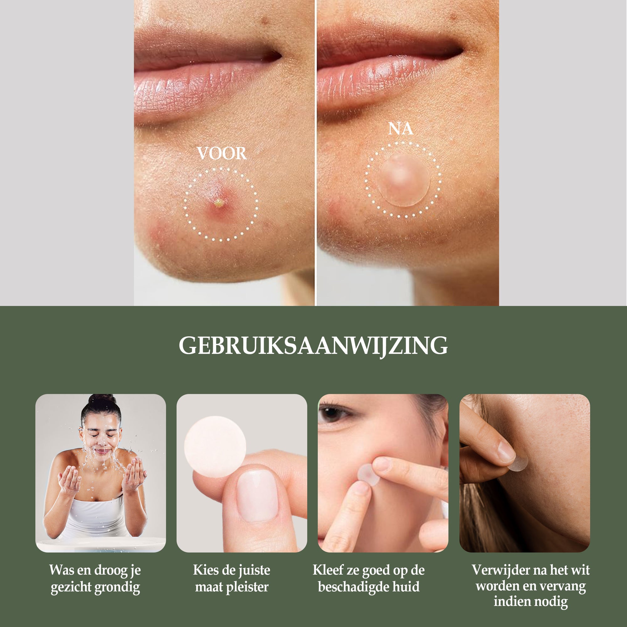 Pimple Patches Day&Night
